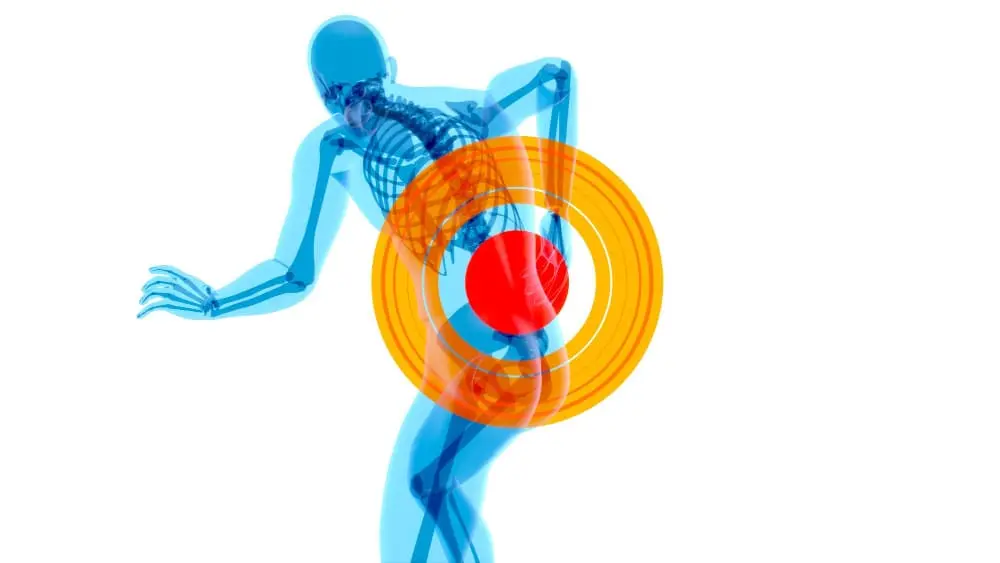 Trigger-point-et-Dry-needling-PAPL-Formation